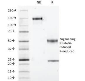 S100B / S100 Beta Antibody (clone S100B/1012, Ready-to-Use)