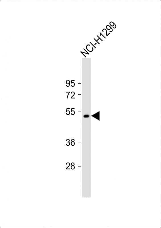 F7 / Factor VII Antibody (aa302-332)