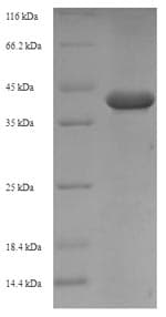Peanut Allergen Ara h 1 Protein (Recombinant 6His-SUMO, N-terminus)