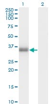 POMC / Proopiomelanocortin Antibody (clone 3E11)