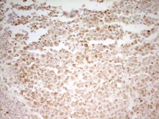 MEF2D Antibody (aa1-282, clone OTI3D12)