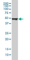 PathPlus™ KRT20 / CK20 / Cytokeratin 20 Antibody (clone 2G3-1C8)