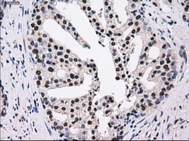 Monoclonal Mouse anti-Human PSMD10 / Gankyrin Antibody (clone OTI3F6, WB)