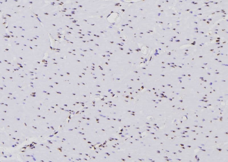 PTPN6 / SHP1 Antibody