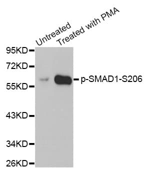 SMAD1 Antibody (phospho-Ser206)