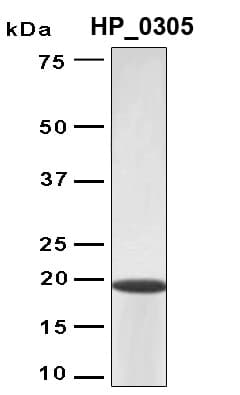 H. pylori HP0305 Protein (Recombinant 6His, N-terminus)