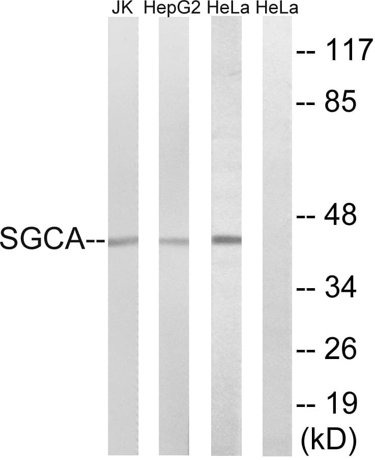 SGCA / DAG2 Antibody (aa161-210)