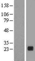 PLA2G12B Protein (Over-Expression Lysate Myc-DDK (Flag))