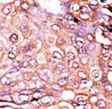 EP300 / p300 Antibody (phospho-Ser89)