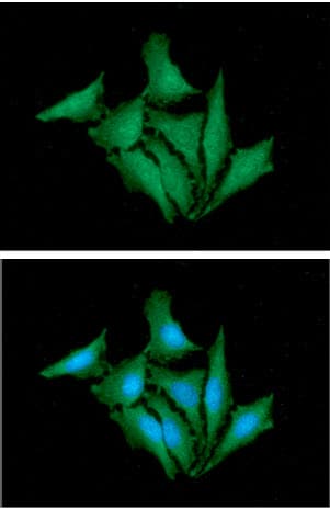 IHC-plus™ HPRT1 / HPRT Antibody (clone AT1D9)