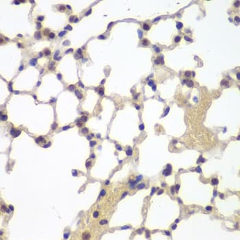 ESR2 / ER Beta Antibody