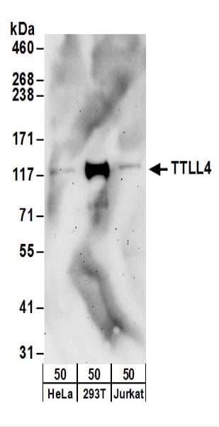 TTLL4 Antibody (aa1149-1199)