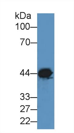 CKM / Creatine Kinase MM Antibody (aa11-367)