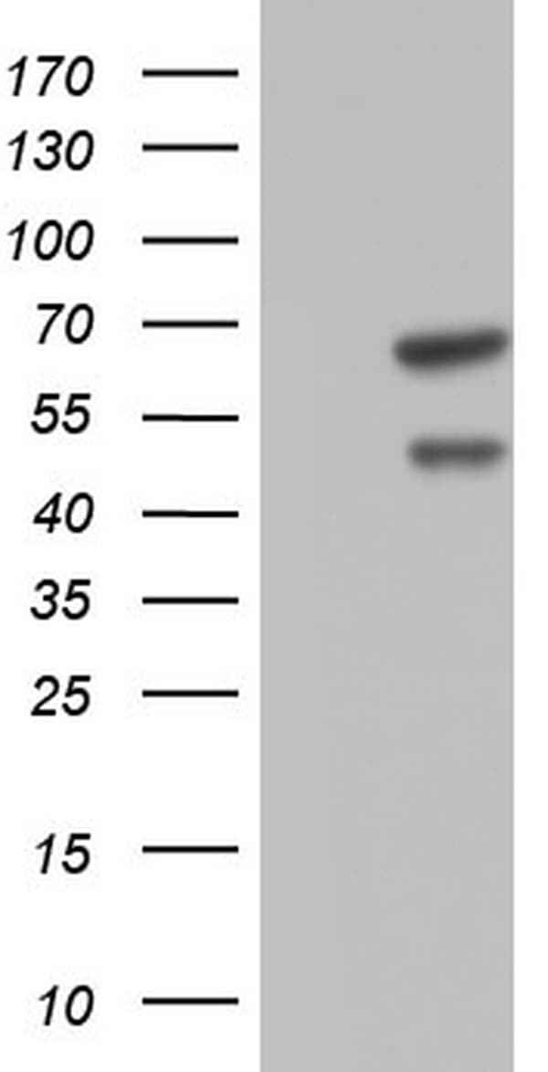 CFLAR / FLIP Antibody (aa1-272, clone OTI2H8)