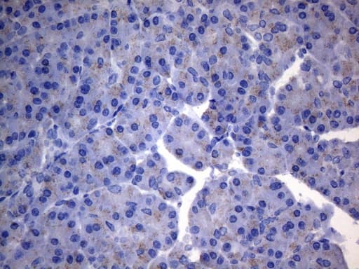 SDHB Antibody (clone OTI2A1)