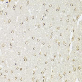 Polyclonal Rabbit anti-Human XRCC6 / Ku70 Antibody (IHC, IF, WB)
