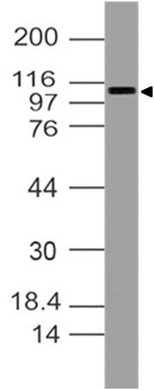 RB1 / Retinoblastoma / RB Antibody