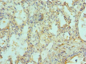 SIAH1 Antibody (aa1-313)