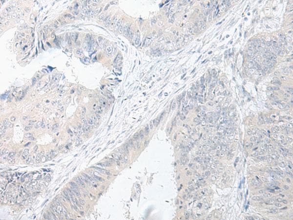 Polyclonal Rabbit anti-Human GASP2 / GPRASP2 Antibody (IHC)