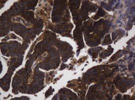 ASGR2 Antibody (clone OTI2A12)