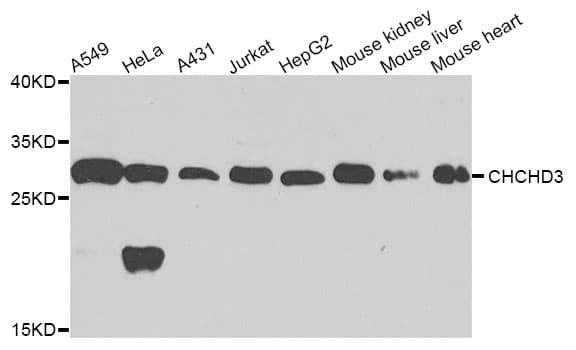 Polyclonal Rabbit anti-Human CHCHD3 Antibody (IHC, WB)