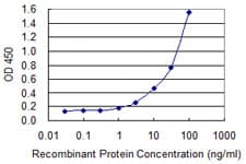 IHC-plus™ Monoclonal Mouse anti-Human ACTB / Beta Actin Antibody (clone 1E7, IHC, WB)