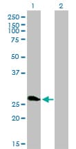 RNF114 / ZNF313 Antibody (clone 4G3-1A10)