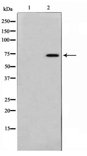 FOXO1 / FKHR Antibody (phospho-Ser256)