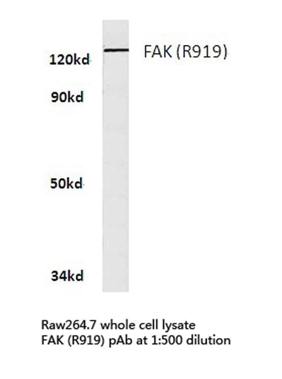 Polyclonal Rabbit anti-Human FAK / Focal Adhesion Kinase Antibody (Arg919, IHC, IF, WB)