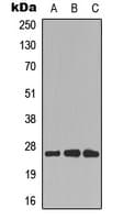 CDCA4 Antibody (Internal)