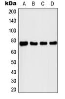Polyclonal Rabbit anti-Human IRAK1 / IRAK Antibody (phospho-Thr209, WB)