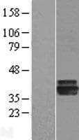 AGMAT Protein (Over-Expression Lysate Myc-DDK (Flag))