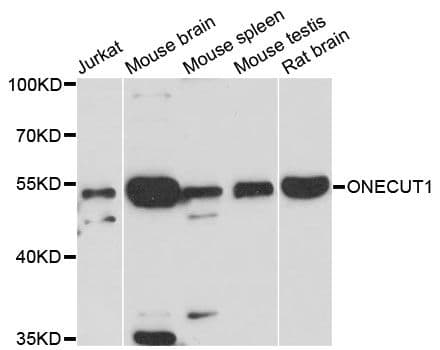 Polyclonal Rabbit anti-Human ONECUT1 / HNF6 Antibody (WB)