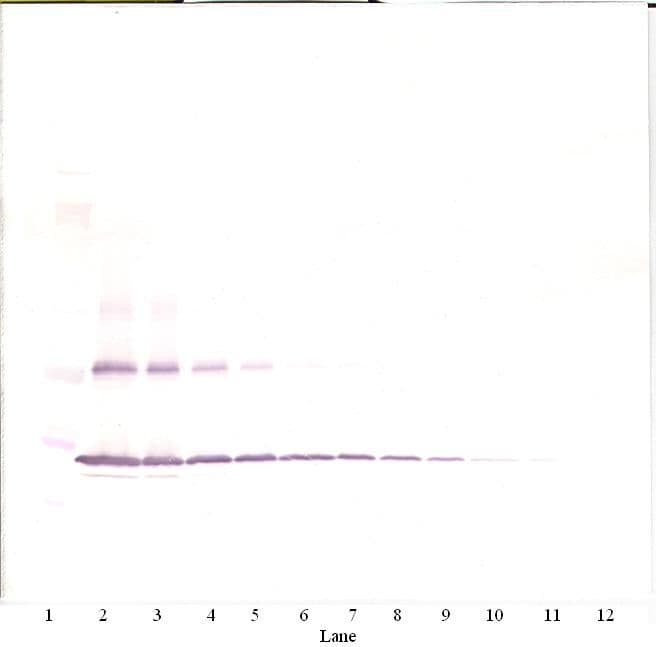 IL-1B / IL-1 Beta Antibody