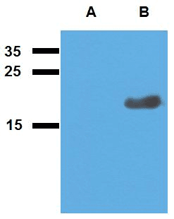 Mycobacterium tuberculosis Acr2 Antibody (clone Polyclonal)