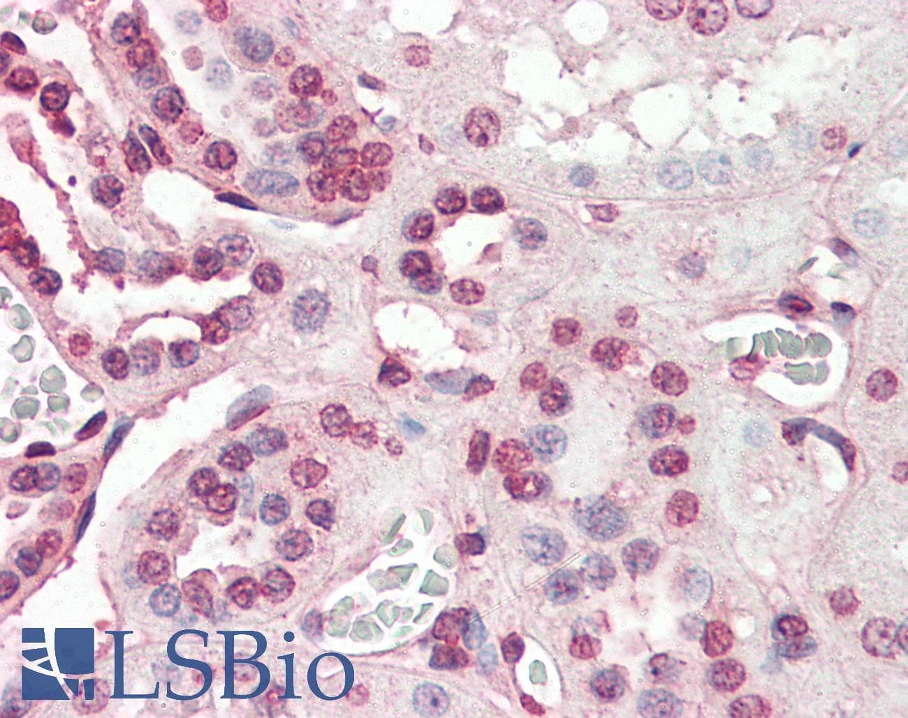 IHC-plus™ Polyclonal Goat anti-Human PIAS2 / PIASX Antibody (aa431-445, IHC)