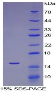 Mouse ACE / CD143 Protein (Recombinant His-S)