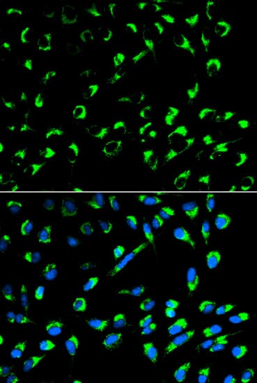 SFN / Stratifin / 14-3-3 Sigma Antibody