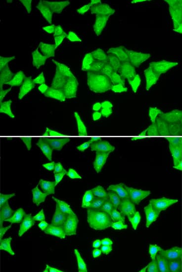 Polyclonal Rabbit anti-Human TRIM27 Antibody (IHC, IF, WB)