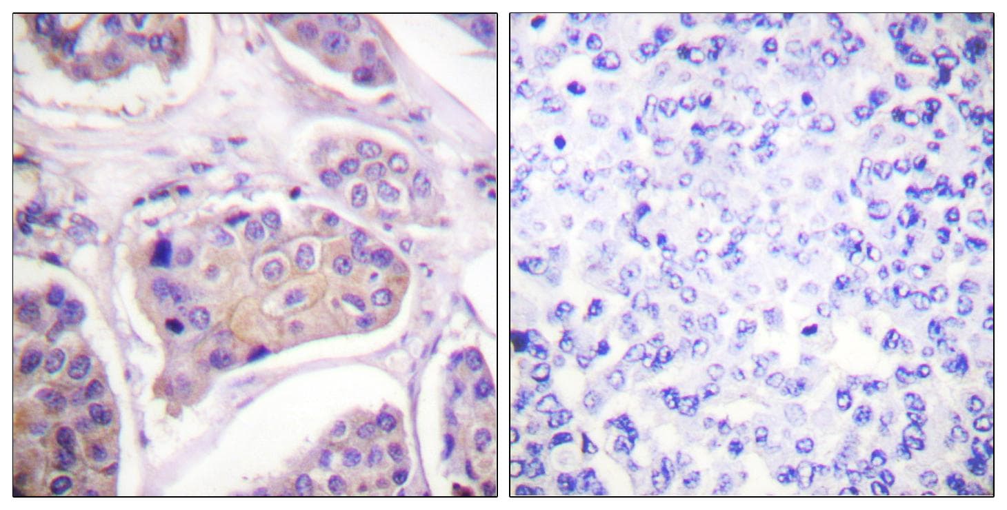 EGFR Antibody (phospho-Tyr1016)