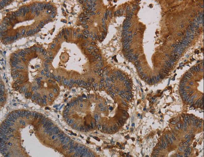KRT16 / CK16 / Cytokeratin 16 Antibody