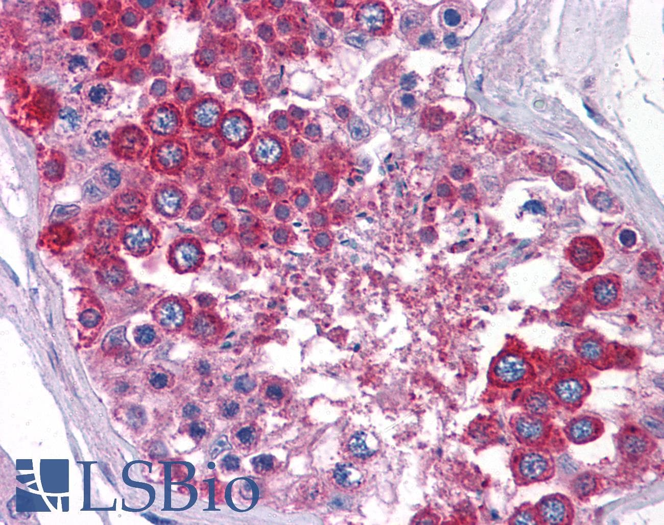 IHC-plus™ SLC39A3 / ZIP3 Antibody