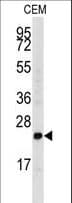 FGF4 Antibody (aa168-198)