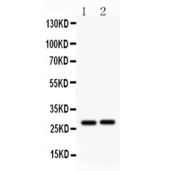 IGFBP1 Antibody (aa177-207)