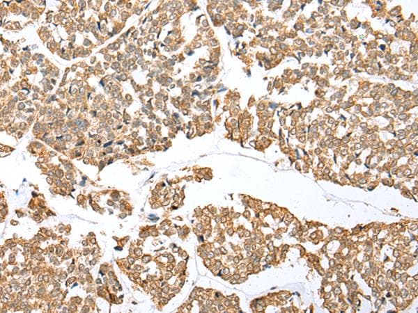 NDUFB3 Antibody