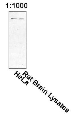 HIP1 Antibody (clone 1E1)