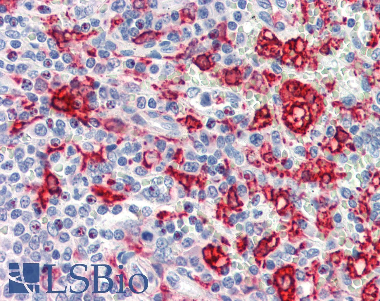IHC-plus™ Polyclonal Rabbit anti-Human HMOX1 / HO-1 Antibody (IHC, WB)