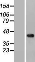 CD1B Protein (Over-Expression Lysate Myc-DDK (Flag))