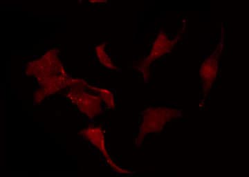 Polyclonal Rabbit anti-Human KCNC1 / Kv3.1 Antibody (IF, WB)