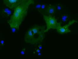 MOBKL2B / MOB3B Antibody (clone OTI5C7, Carrier-free)